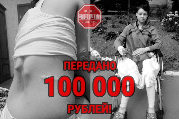 Юлии Гавриковой перечислены средства собранные на реабилитацию